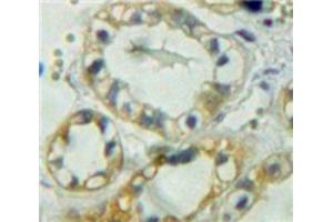 Used in DAB staining on fromalin fixed paraffin-embedded Kidney tissue (PTPRM antibody  (AA 1197-1403))
