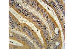 Immunohistochemistry (IHC) image for anti-Wingless-Type MMTV Integration Site Family, Member 10B (WNT10B) (AA 193-222) antibody (ABIN3029625)