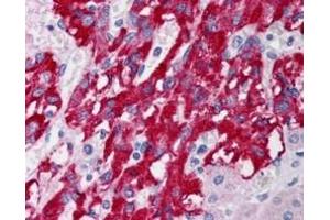 Immunohistochemistry (IHC) image for anti-Deleted in Liver Cancer 1 (DLC1) (AA 2-13) antibody (ABIN292727)