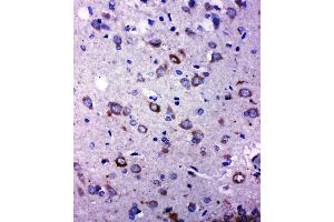 Immunohistochemistry (IHC) image for anti-Transient Receptor Potential Cation Channel, Subfamily C, Member 6 (TRPC6) (AA 249-265), (Middle Region) antibody (ABIN3044146)