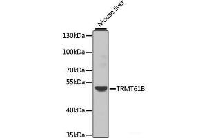 Western blot analysis of extracts of Mouse liver using TRMT61B Polyclonal Antibody at dilution of 1:1000. (TRMT61B antibody)