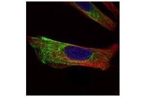 ICC/IF Image Confocal immunofluorescence analysis (Olympus FV10i) of paraformaldehyde-fixed HeLa, using Cytokeratin 17, antibody (Green) at 1:500 dilution.