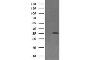 Western Blotting (WB) image for anti-T-cell surface glycoprotein CD1c (CD1C) antibody (ABIN1497192) (CD1c antibody)