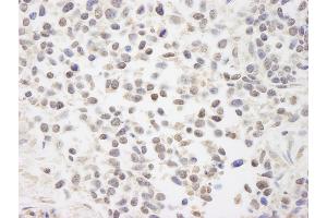 Immunohistochemistry (IHC) image for anti-Chromosome 7 Open Reading Frame 27 (C7orf27) (C-Term) antibody (ABIN7448427)