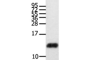 Western Blot analysis of Human brain glioma tissue using CCL28 Polyclonal Antibody at dilution of 1:450