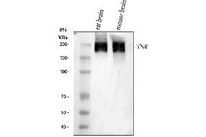 Western blot analysis of TNR using anti-TNR antibody (ABIN4886752).