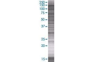DNMT3A transfected lysate. (DNMT3A 293T Cell Transient Overexpression Lysate(Denatured))