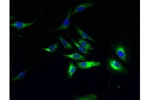 Immunofluorescent analysis of Hela cells using ABIN7153355 at dilution of 1:100 and Alexa Fluor 488-congugated AffiniPure Goat Anti-Rabbit IgG(H+L)