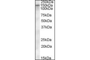 Image no. 2 for anti-Solute Carrier Family 12 (Potassium-Chloride Transporter) Member 4 (SLC12A4) (Internal Region) antibody (ABIN372748) (SLC12A4 antibody  (Internal Region))