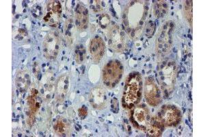Immunohistochemical staining of paraffin-embedded Human Kidney tissue using anti-PGM3 mouse monoclonal antibody.