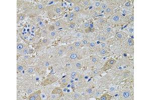 Immunohistochemistry of paraffin-embedded Human liver using GLA Polyclonal Antibody at dilution of 1:100 (40x lens). (GLA antibody)