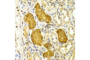 Immunohistochemistry of paraffin-embedded Human kidney using PRKCE antibody (ABIN5971136) at dilution of 1/100 (40x lens).