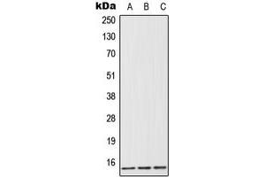 Western blot analysis of FABP1 expression in HeLa (A), Jurkat (B), rat liver (C) whole cell lysates.