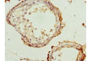 Immunohistochemistry of paraffin-embedded human testis tissue using ABIN7168074 at dilution of 1:100 (Rhotekin antibody  (AA 304-563))