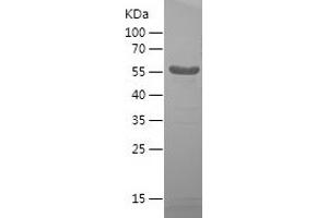 Western Blotting (WB) image for Drebrin 1 (DBN1) (AA 480-649) protein (His-IF2DI Tag) (ABIN7122708) (DBN1 Protein (AA 480-649) (His-IF2DI Tag))