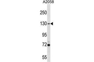 USP7 Antibody (Center) western blot analysis in A2058 cell line lysates (35 µg/lane). (USP7 antibody  (Middle Region))
