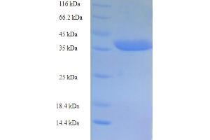 CASP5 Protein (AA 137-327, partial) (His-SUMO Tag)