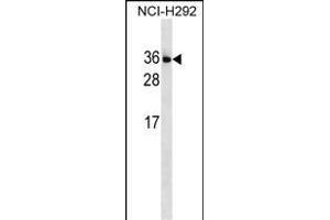IL34 Antibody (N-term) (ABIN1539235 and ABIN2849950) western blot analysis in NCI- cell line lysates (35 μg/lane). (IL-34 antibody  (N-Term))