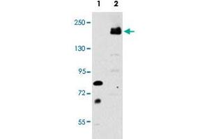 Western blot analysis of LRP6 (arrow) using rabbit LRP6 polyclonal antibody . (LRP6 antibody  (C-Term))