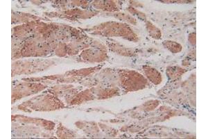 Detection of MYL2 in Human Esophagus Tissue using Polyclonal Antibody to Myosin Light Chain 2 (MYL2)