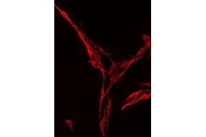 ABIN6275021 staining RAW264. (ST6GAL1 antibody  (Internal Region))