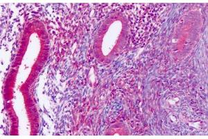 Anti-DUSP23 antibody IHC staining of human uterus, endometrium.