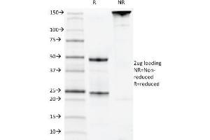 SDS-PAGE Analysis Purified CD22 Mouse Monoclonal Antibody (MYG13). (CD22 antibody)