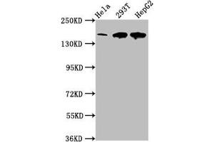 Western Blot Positive WB detected in: Hela whole cell lysate, 293T whole cell lysate, HepG2 whole cell lysate All lanes: LRPPRC antibody at 4 μg/mL Secondary Goat polyclonal to rabbit IgG at 1/50000 dilution Predicted band size: 158 kDa Observed band size: 158 kDa (LRPPRC antibody  (AA 901-1036))