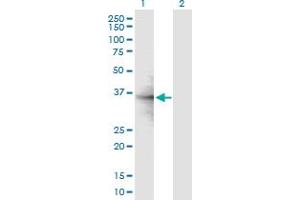 Western Blot analysis of RPL6 expression in transfected 293T cell line by RPL6 MaxPab polyclonal antibody.