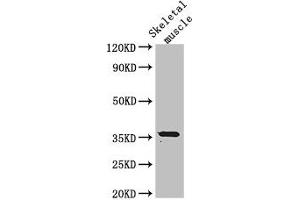 Western Blot Positive WB detected in: Mouse skeletal muscle tissue All lanes: EPM2A antibody at 3 μg/mL Secondary Goat polyclonal to rabbit IgG at 1/50000 dilution Predicted band size: 36, 38, 16, 25, 10, 21, 23 kDa Observed band size: 36 kDa (EPM2A antibody  (Isoform 9))