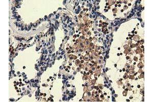 Immunohistochemical staining of paraffin-embedded Human liver tissue using anti-UHMK1 mouse monoclonal antibody. (UHMK1 antibody)