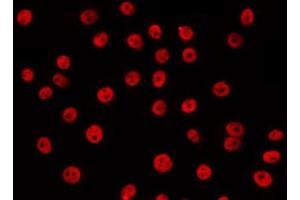 ABIN6266629 staining LOVO by IF/ICC. (RCBTB1 antibody  (Internal Region))