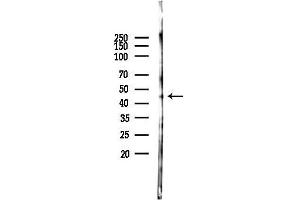 Western blot analysis of lysates from EC304 cells(starvation 24h treatment), using FH Antibody at 1/1000 dilution.
