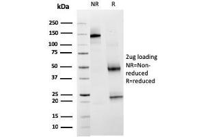 SDS-PAGE Analysis Purified TIM3 Mouse Monoclonal Antibody (TIM3/3113). (TIM3 antibody  (AA 22-202))