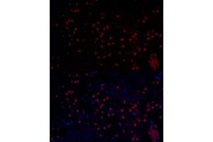 Immunofluorescence analysis of mouse brain using MYCN Rabbit pAb (ABIN1680957, ABIN3015161, ABIN3015163 and ABIN6213865) at dilution of 1:50 (40x lens). (MYCN antibody  (AA 168-267))