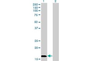 Western Blot analysis of NME3 expression in transfected 293T cell line by NME3 monoclonal antibody (M13), clone 3G10. (NME3 antibody  (AA 73-169))