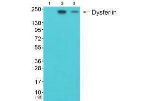 Western blot analysis of extracts from JK cells (Lane 2) and K562 cells (Lane 3), using Dysferlin antiobdy. (Dysferlin antibody)