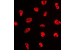 Immunofluorescent analysis of NFYA staining in K562 cells. (NFYA antibody  (C-Term))