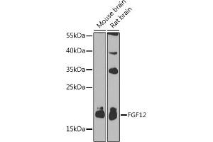 Western blot analysis of extracts of various cell lines, using FGF12 antibody (ABIN3016419, ABIN3016420, ABIN1679841 and ABIN6219744) at 1:1000 dilution. (FGF12 antibody  (AA 1-181))