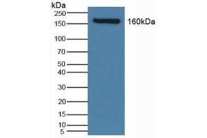 Detection of NCCT in Human Serum using Polyclonal Antibody to Na-Cl Cotransporter (NCCT) (SLC12A3 antibody  (AA 867-1024))