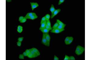 Immunofluorescence staining of HepG2 cells with ABIN7155245 at 1:66, counter-stained with DAPI. (HAL antibody  (AA 36-152))