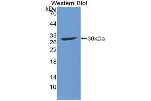 Detection of Recombinant C4, Gallus using Polyclonal Antibody to Complement Component 4 (C4)
