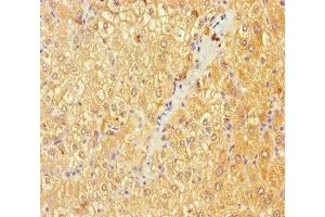 Immunohistochemistry of paraffin-embedded human liver tissue using ABIN7145392 at dilution of 1:100 (B4GALT3 antibody  (AA 34-393))