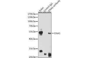 Immunoprecipitation analysis of 200 μg extracts of Mouse brain cells using 3 μg GNAS antibody (ABIN6127959, ABIN6141213, ABIN6141214 and ABIN6221191). (GNAS antibody  (AA 1-394))