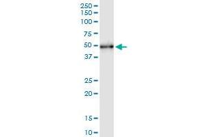 Immunoprecipitation of UIMC1 transfected lysate using anti-UIMC1 MaxPab rabbit polyclonal antibody and Protein A Magnetic Bead , and immunoblotted with UIMC1 MaxPab mouse polyclonal antibody (B01) . (UIMC1 antibody  (AA 1-385))