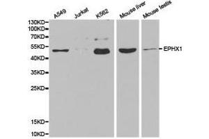 Western Blotting (WB) image for anti-Epoxide Hydrolase 1, Microsomal (Xenobiotic) (EPHX1) antibody (ABIN1872557)