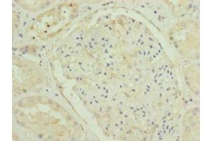 Immunohistochemistry of paraffin-embedded human kidney tissue using ABIN7151254 at dilution of 1:100 (TRIM31 antibody  (AA 186-425))