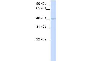 WB Suggested Anti-C2orf18 Antibody Titration:  0. (SLC35F6 antibody  (Middle Region))
