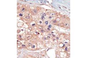 Image no. 2 for anti-U2AF Homology Motif (UHM) Kinase 1 (UHMK1) (N-Term) antibody (ABIN360529) (UHMK1 antibody  (N-Term))