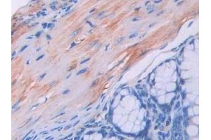 Immunohistochemistry (IHC) image for anti-Urocortin 3 (UCN3) (AA 24-149) antibody (ABIN7435364)